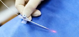 Laserowe leczenie żylaków – jak wygląda?