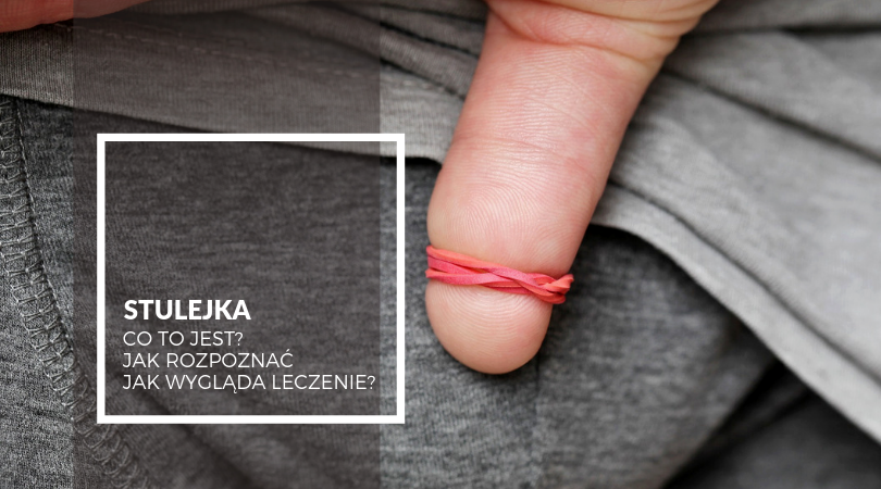 Mastka Pod Napletkiem Jak Usunąć Co To Jest Pranie Wstępne - Margaret Wiegel