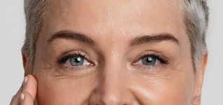 Brow lifting (direct brow lift)