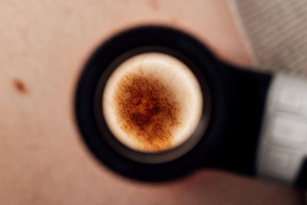 dermatoskopia warszawa doktor zajac