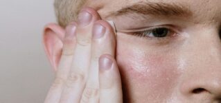 Choroby skóry (dermatozy) – jakie występują najczęściej? Jak je rozpoznać i leczyć?