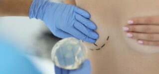 Usuwanie implantów piersiowych